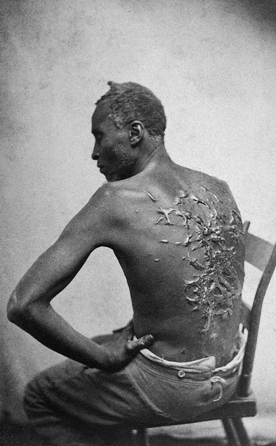 Sejarah panjang perbudakan manusia, dari zaman kuno hingga penghapusan hukumnya di era modern