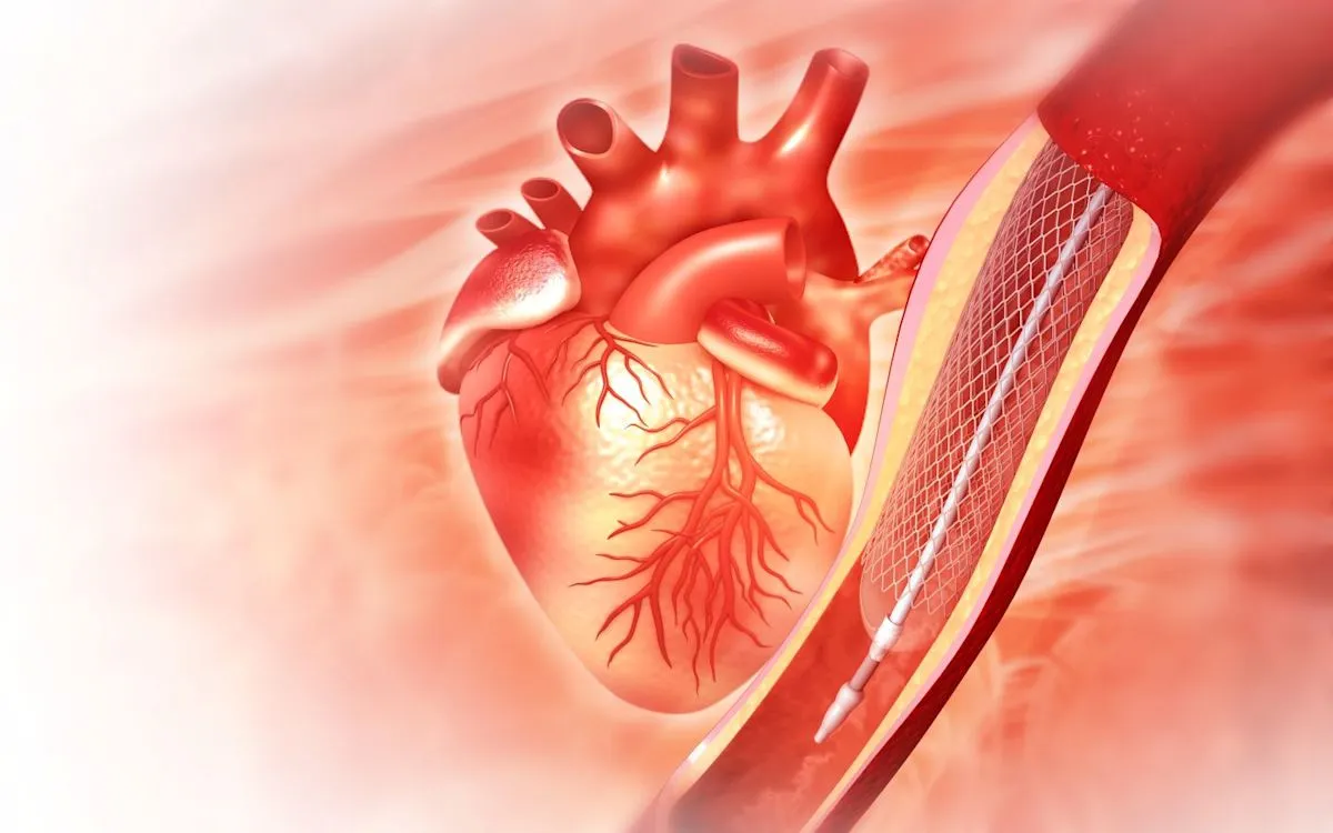 Teknologi FFR Heartflow mampu kurangi prosedur angiografi koroner invasif yang tidak perlu